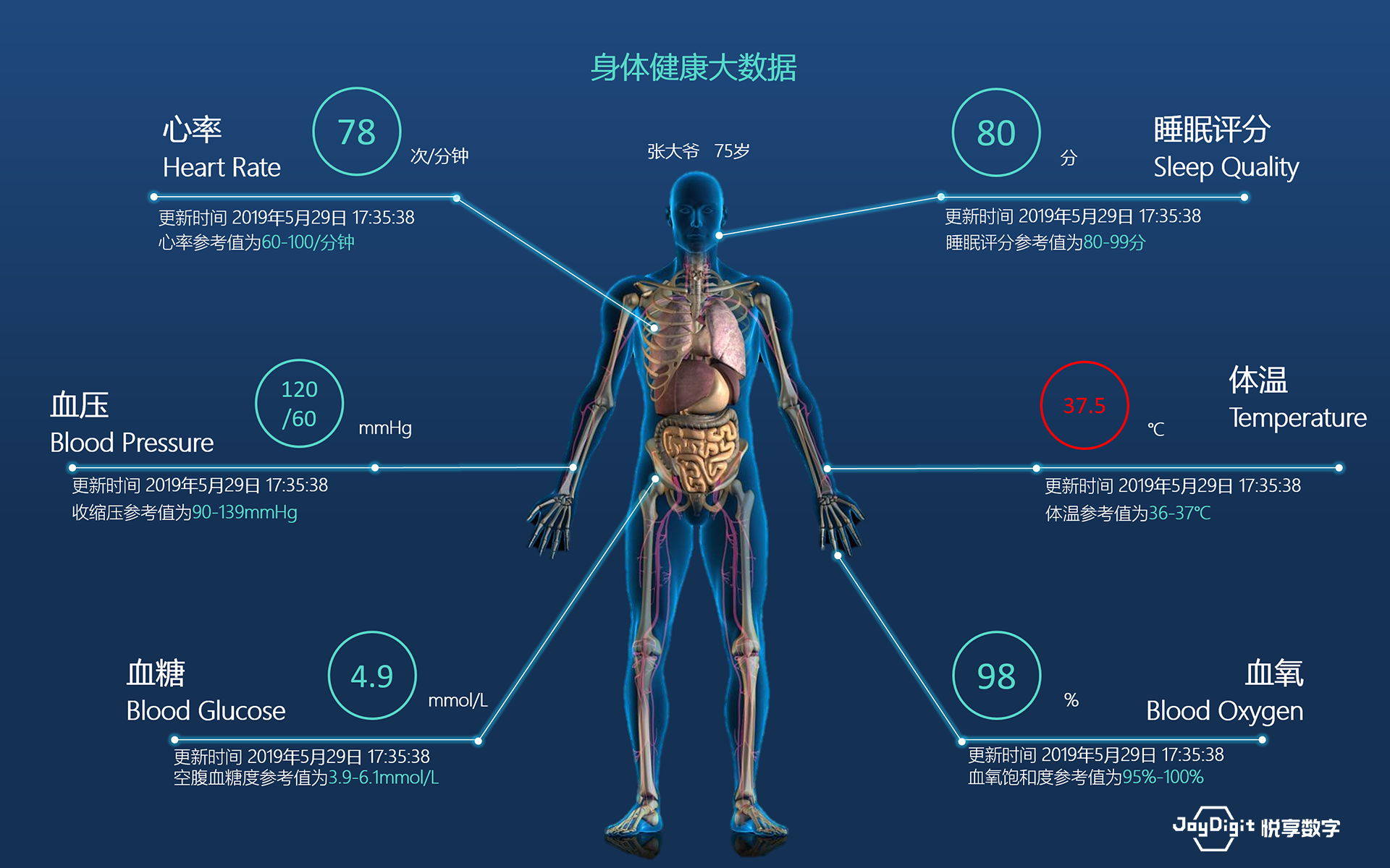 消费日报：悦享数字推动新兴技术与养老服务相结合，加快养老行业数字化转型(图9)